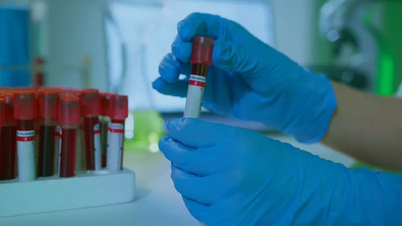 What Your Liver Is Trying to Tell You: HIV, Hepatitis Coinfection, and the Biomarkers That Demand Your Attention
